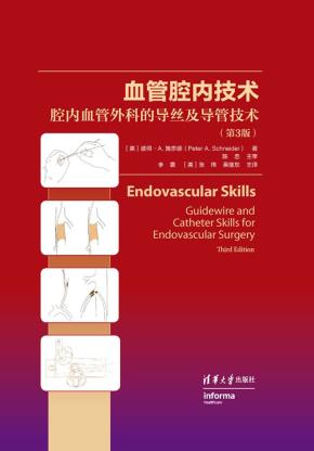 血管腔内技术:腔内血管外科的导丝及导管技术(第3版)