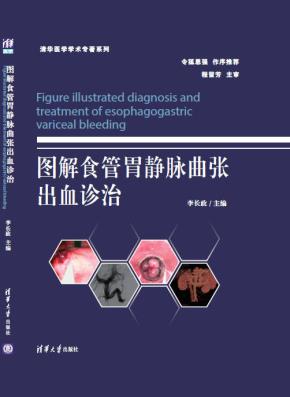 图解食管胃静脉曲张出血诊治