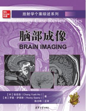 放射学个案综述系列：脑部成像