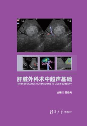 肝脏外科术中超声基础